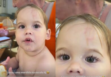 Filho de Virginia é mordido na escola e caso repercute