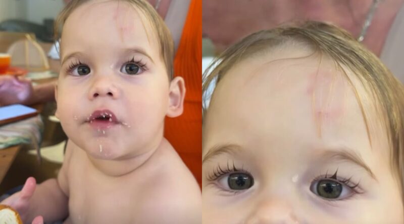 Filho de Virginia é mordido na escola e caso repercute