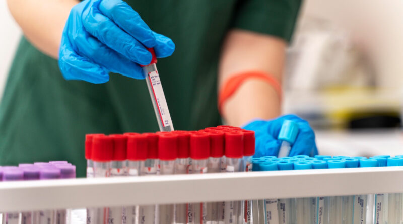 UBSs de Goiânia passam a oferecer exames laboratoriais aos sábados